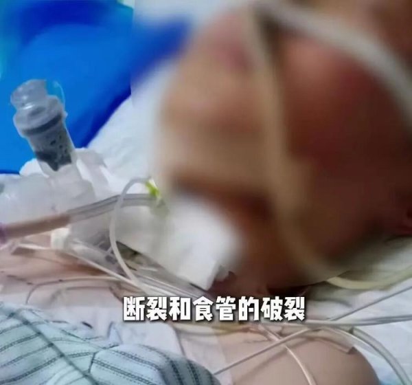 男孩骑车被绳子割喉？决不能为了“图省事”拿公共安全当儿戏