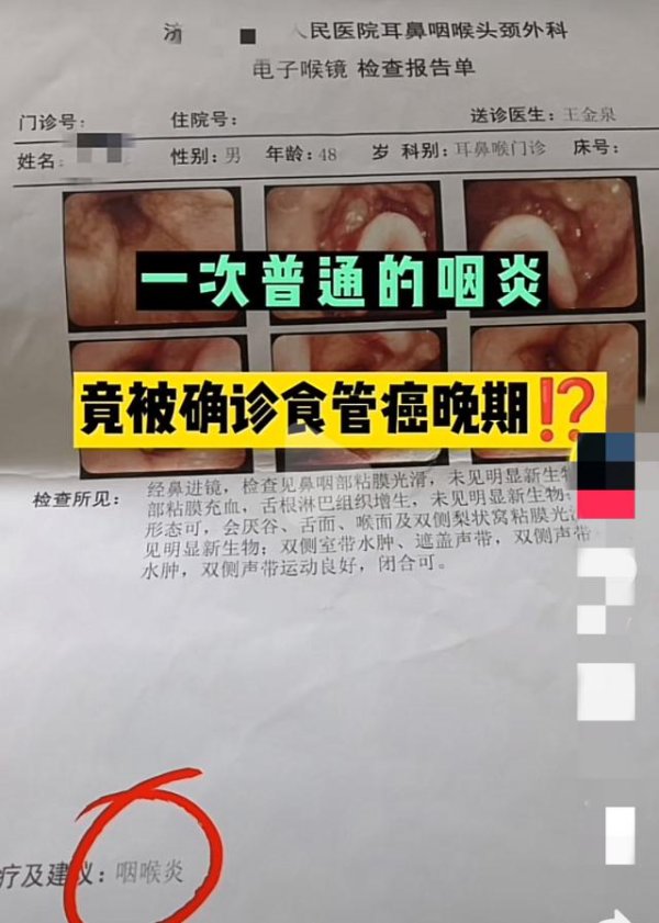 总觉得喉咙痒、咽喉痛，竟然查出“癌”！医生：和这种吃饭习惯有关